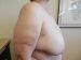 Breast Reduction Patient 12 Before - 5 Thumbnail