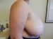 Breast Reduction Patient 02 Before - 3 Thumbnail