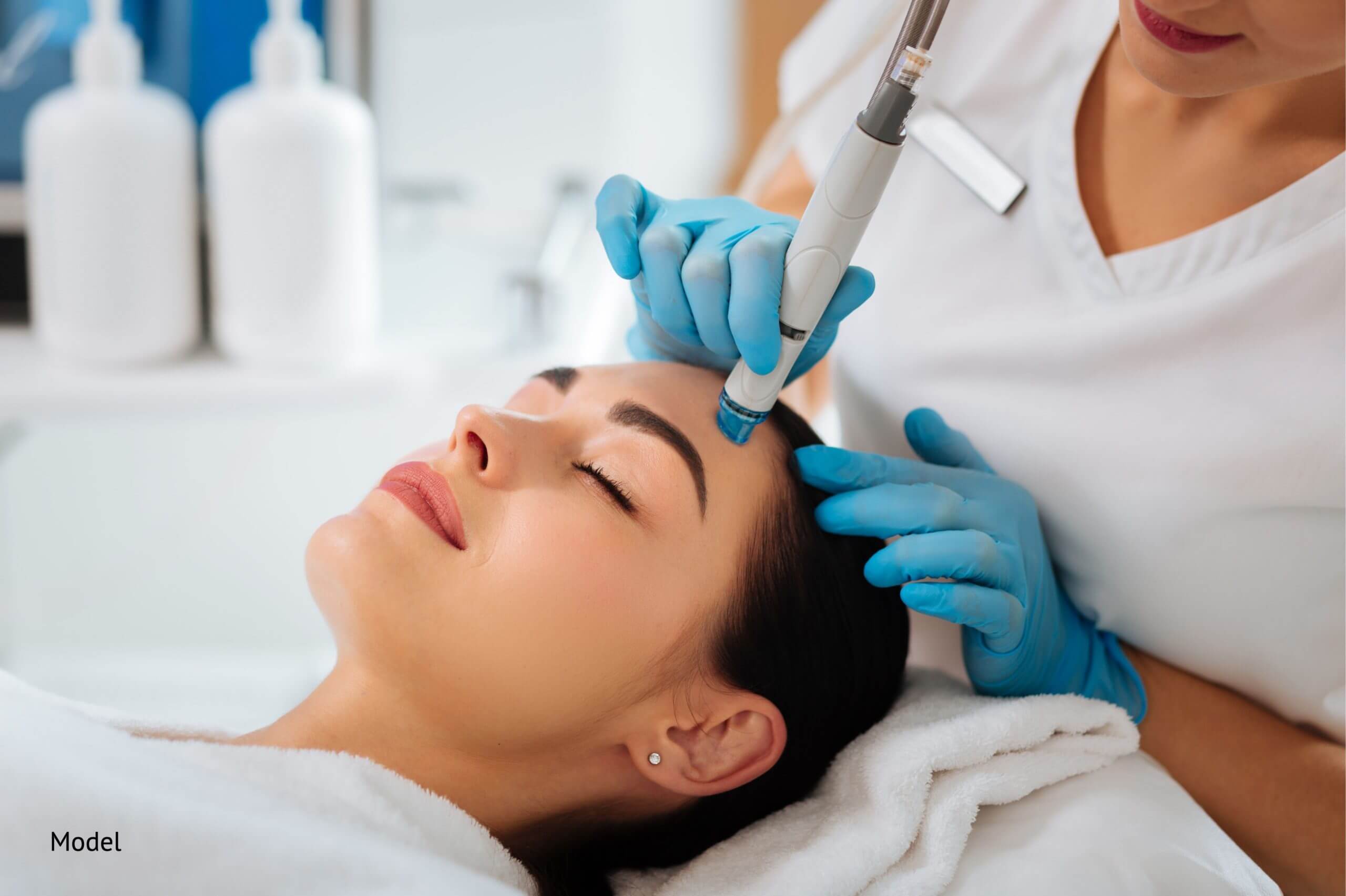 Microneedling treatment using a dermapen on a woman