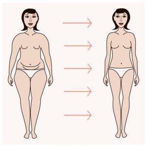 Illustrated diagram of before and after a Mommy Makeover - Tummy tuck, liposuction, and breast augmentation on a female figure.
